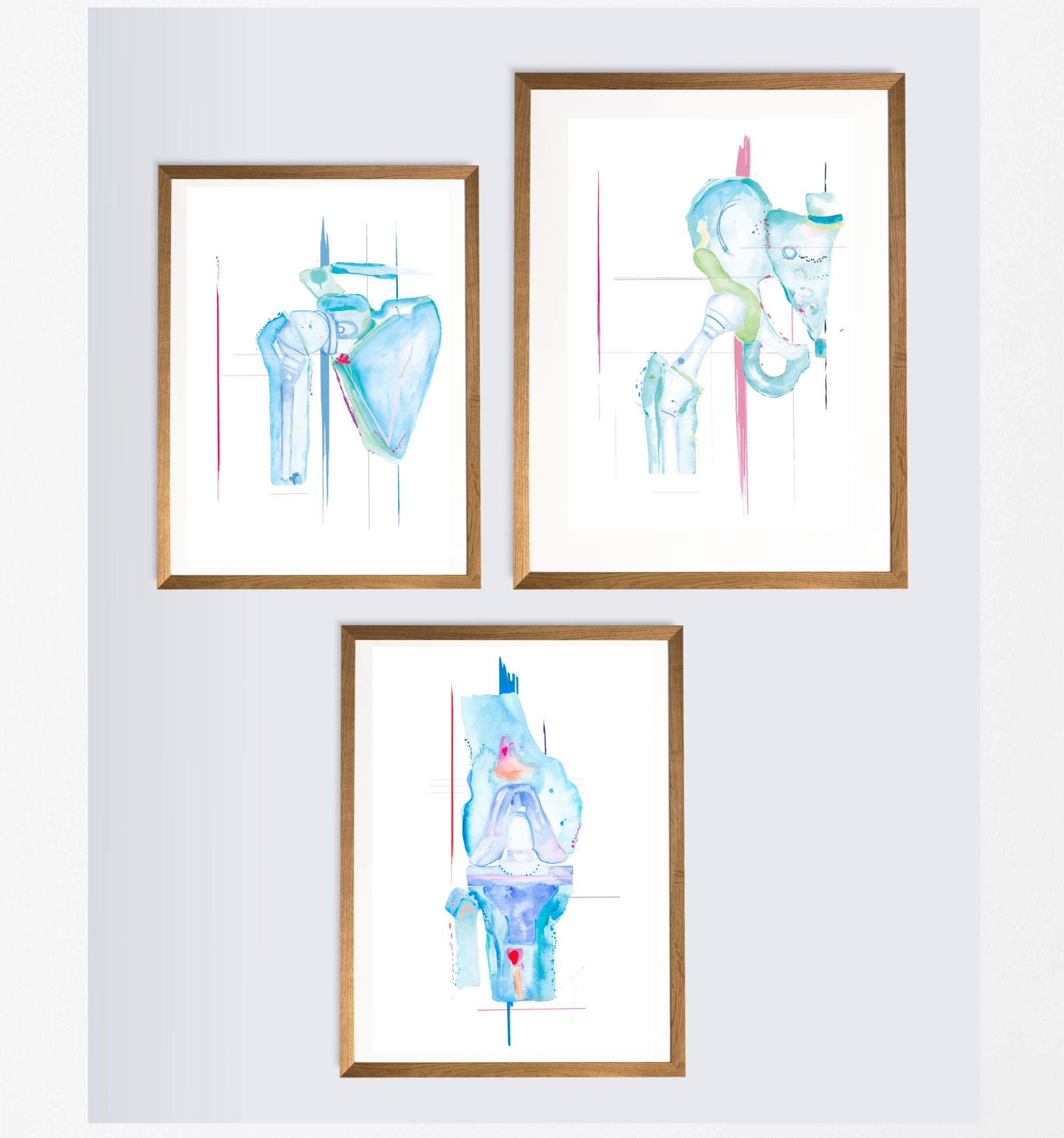 arthroplasty set of three watercolor art prints for orthopedic surgery offices