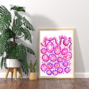 Colon Polyp Histopathology Art