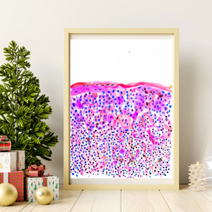 Melanoma Watercolor Art Print