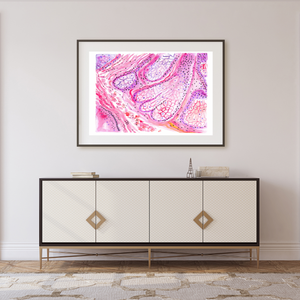 Sebaceous Gland Histology Art Print