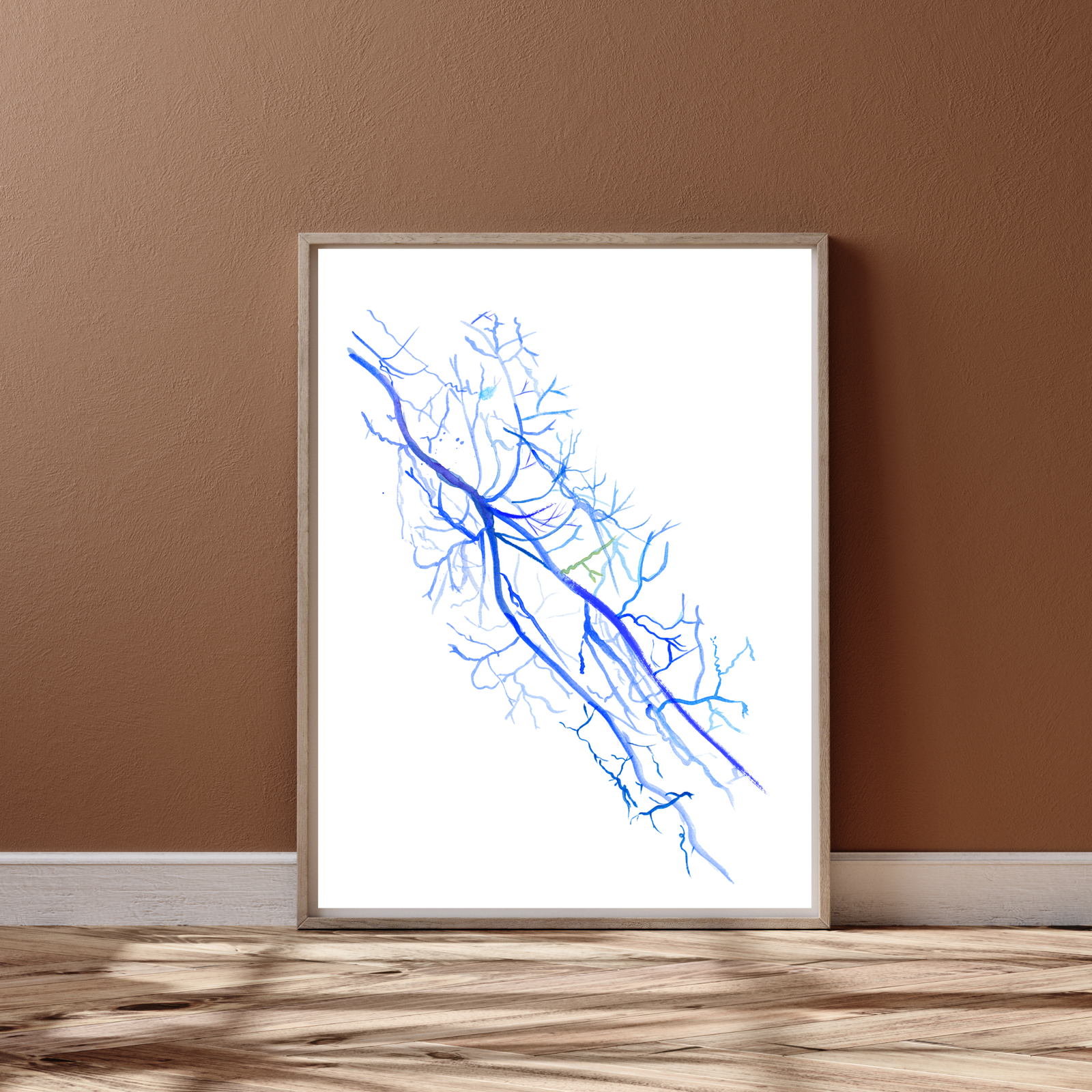 Arm Angiography