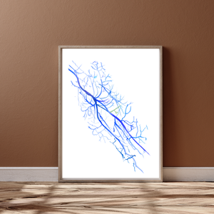 Arm Angiography