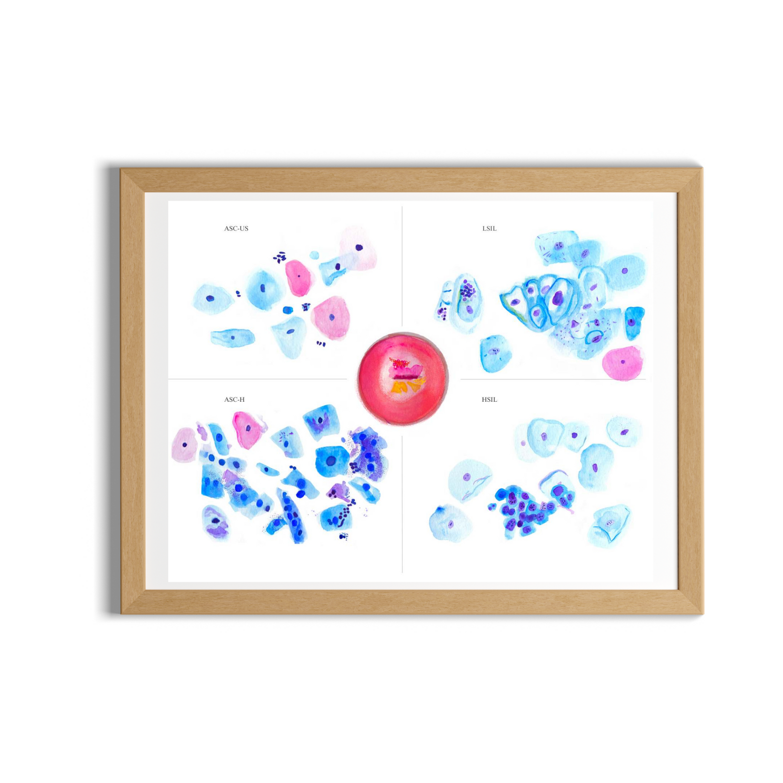 Cervix Cytology Art Print