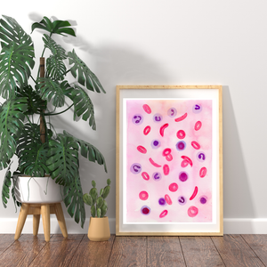 Sickle Cell Anemia Histopathology Art Print