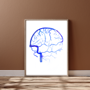 Brain Angiography Venous Phase Watercolor Art