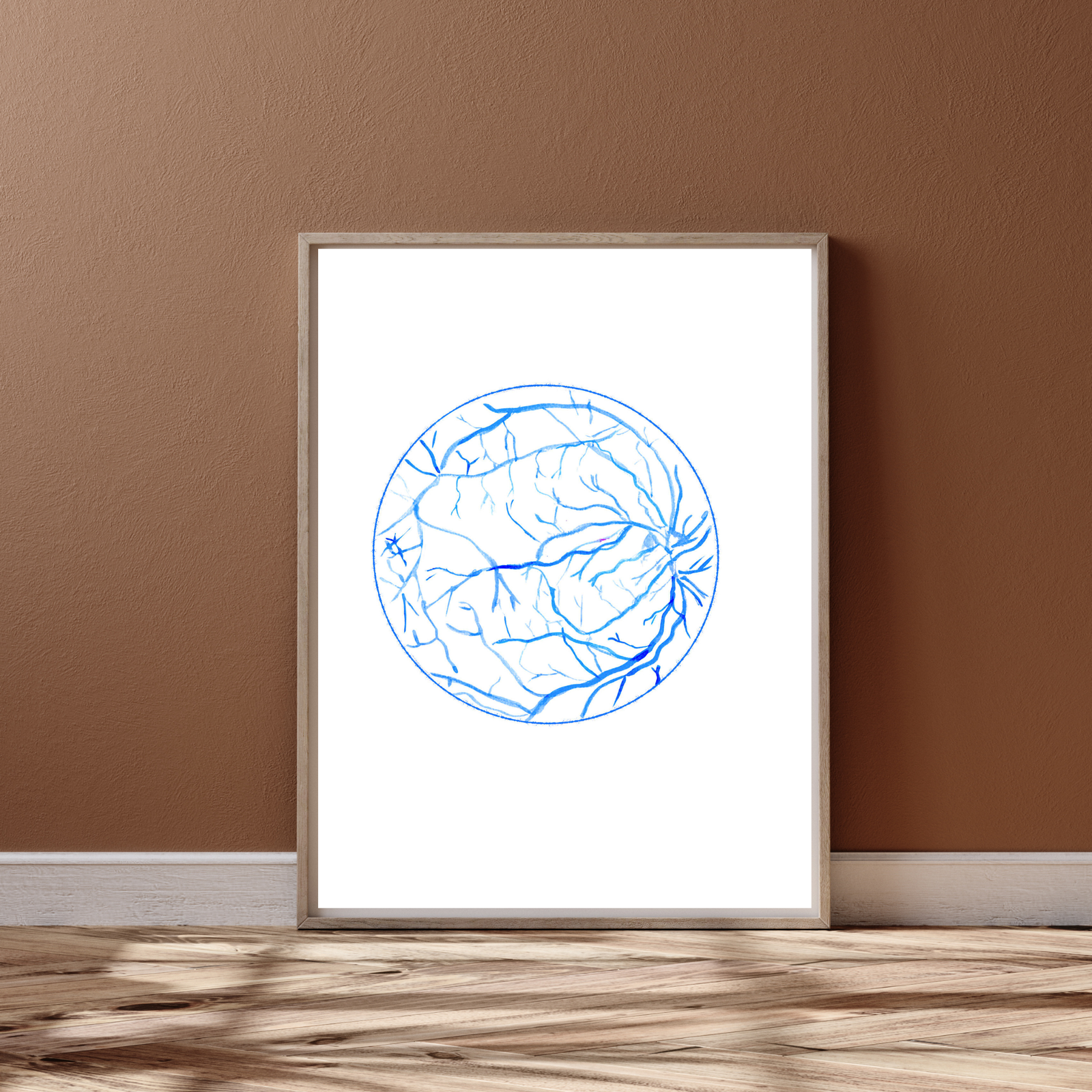 Eye Fluorescein Angiography Ophthalmology Art
