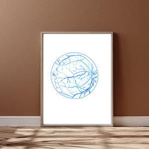 Eye Fluorescein Angiography Ophthalmology Art