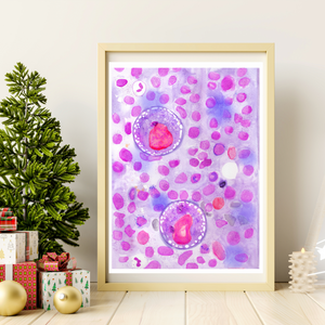 Hodgkin Lymphoma Watercolor Art Print