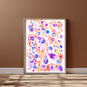 Mastocytosis Bone Marrow Smear Watercolor Art Print