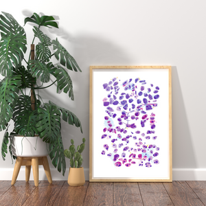 Prostate Adenocarcinoma, metastatic. Abstract Pathology Artwork, Histopathologist Gift