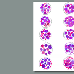 Diazepam - Valium Benzodiapine Molecule Watercolor Art Print