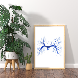 Pulmonary Embolism CT Angiography Watercolor Art Print