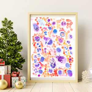 Mastocytosis Bone Marrow Smear Watercolor Art Print