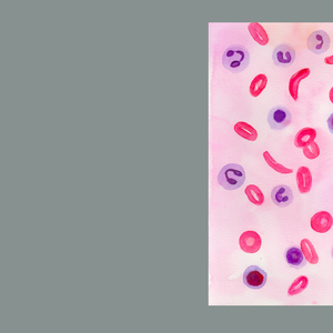 Sickle Cell Anemia Histopathology Art Print