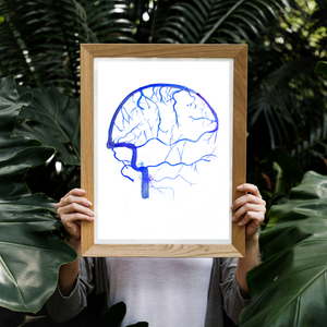 Brain Angiography Venous Phase Watercolor Art