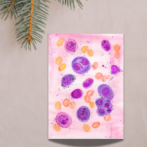 Multiple Myeloma Histopathology Art