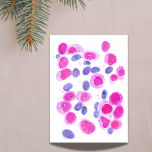 Acute Myeloid Leukemia Art