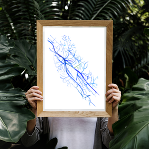 Arm Angiography
