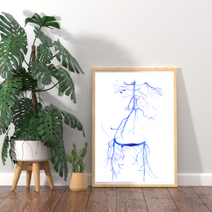 Crossover iliac artery bypass