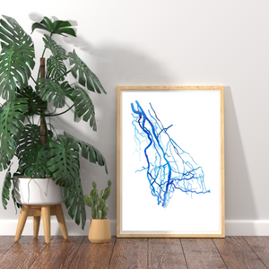Upper Limb DSA, Vascular Surgery Radiology Art Print