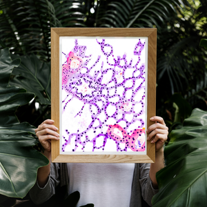 Lung Parenchyma Histology Watercolor Art