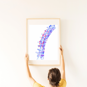 Spine Surgery Art Print
