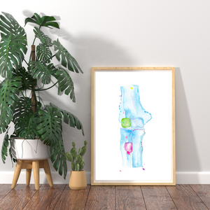 Elbow Anatomy, Orthopedic Surgery and Physical Therapy Office Art Print