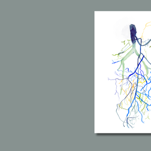 Mesenteric Arteries Angiogram