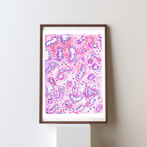 Renal Transplant Tubulitis Acute TcMR Pathology Watercolor Art Print