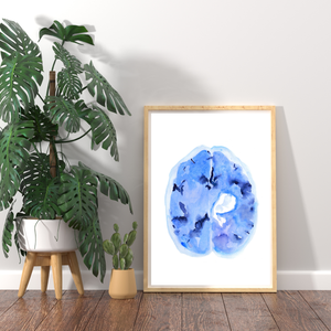 Hemorrhagic Stroke Watercolor Art Print