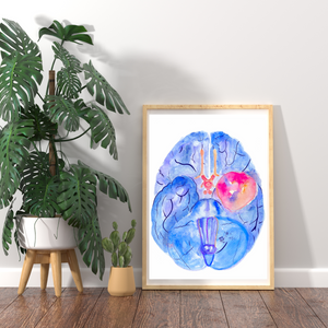 Meningioma Brain Anatomy Watercolor Art Print