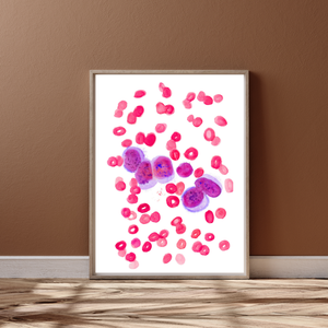 Veterinary Pathology - Dog Acute Lymphocytic Leukemia ALL