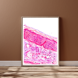 Sun Damaged Aging Skin Histology Art
