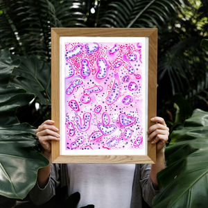 Renal Transplant Tubulitis Acute TcMR Pathology Watercolor Art Print