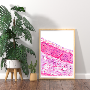 Sun Damaged Aging Skin Histology Art