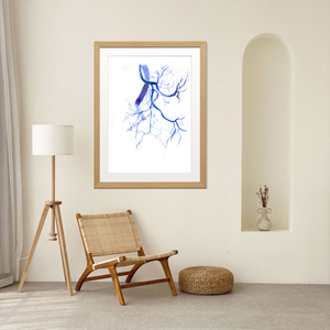 Prostatic Artery Embolization Watercolor Art print