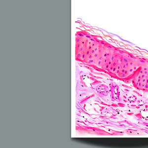 Sun Damaged Aging Skin Histology Art