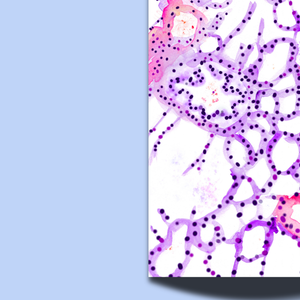 Lung Parenchyma Histology Watercolor Art