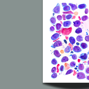 Veterinary Pathology - Dog Lymphoma Histopathology Art