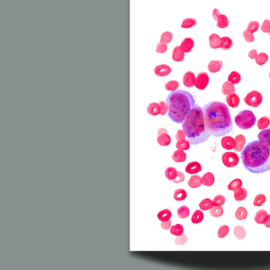 Veterinary Pathology - Dog Acute Lymphocytic Leukemia ALL