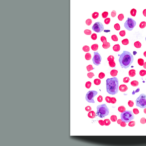 Veterinary Pathology - Dog Chronic Lymphocytic Leukemia - CLL