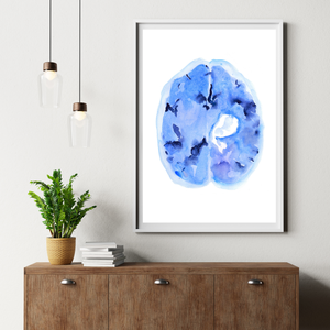 Hemorrhagic Stroke Watercolor Art Print