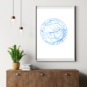 Eye Fluorescein Angiography Ophthalmology Art