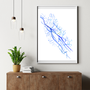 Arm Angiography