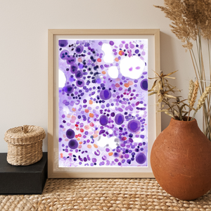 ITP - Idiopathic Thrombocytopenia Bone Marrow Aspirate