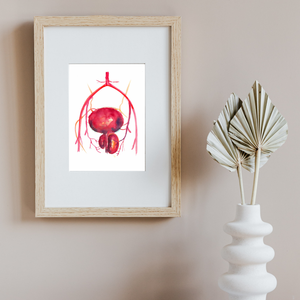 Prostatic Artery Embolization Art