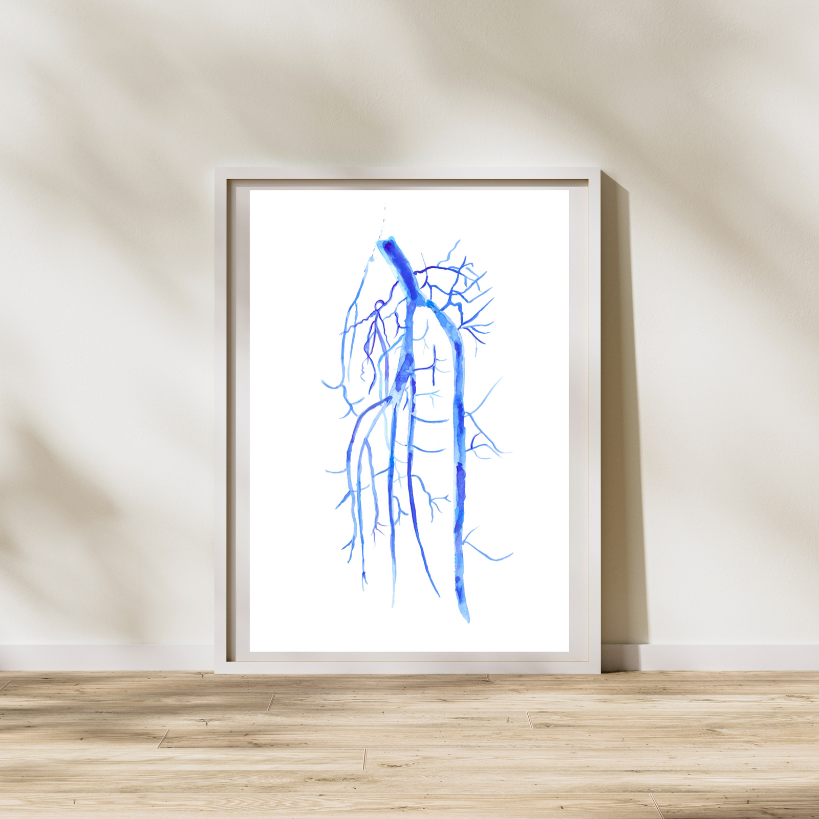 Popliteo-tibial Angiography Art Print