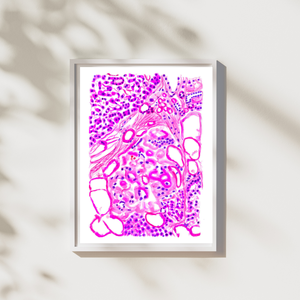 Diabetes Art, Pathology Art, Histopathology Art, Pathology Assistant, Diabetes type 2, Pathologist Gifts, Diabetes Poster, Pancreas