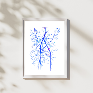 Arm Angiography