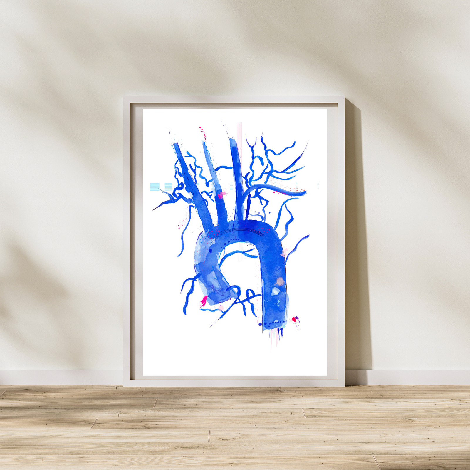 Aorta Anatomy, Cardiology Art Print, Interventional Radiology Wall Art